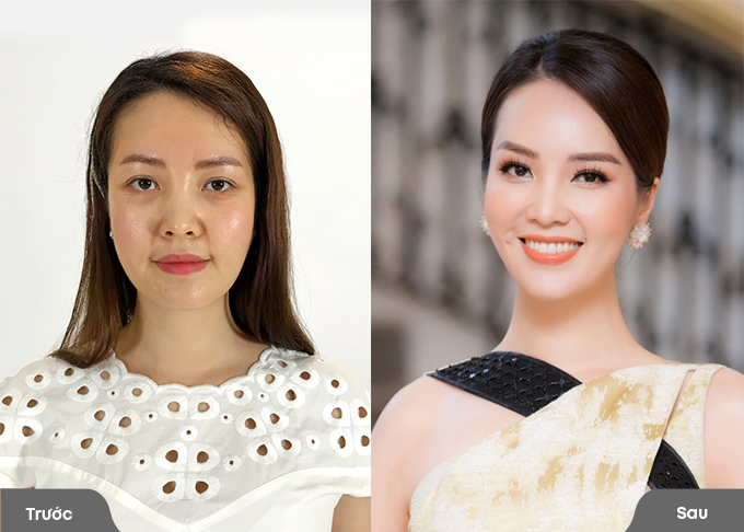 Á hậu Thụy Vân cho biết Saigon Smile Spa địa chỉ chăm sóc sắc đẹp của cô suốt hơn 10 năm qua